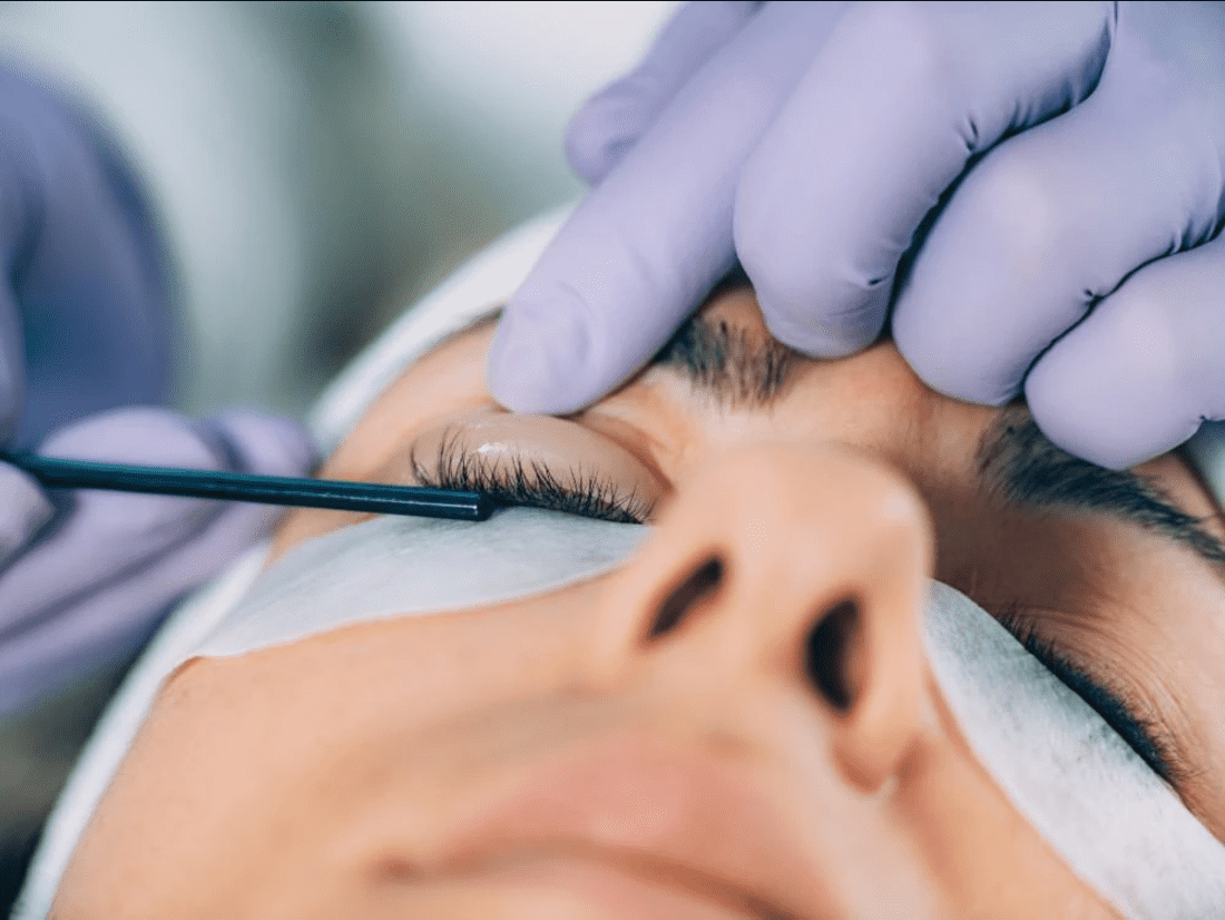 Warum fallen manchmal die Wimpern nach dem Wimpernlifting aus?